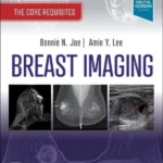 Breast Imaging, 4th Edition The Core Requisites
