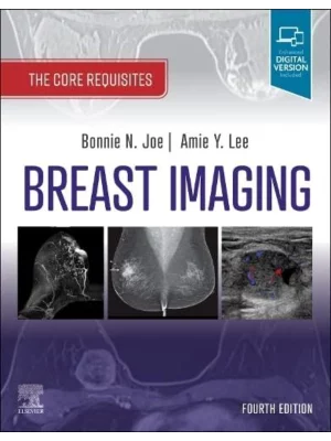 Breast Imaging, 4th Edition The Core Requisites 1