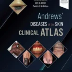 Andrews' Diseases of the Skin Clinical Atlas, 2nd Edition