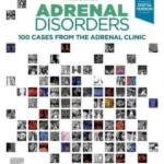 Adrenal Disorders100 Cases from the Adrenal Clinic