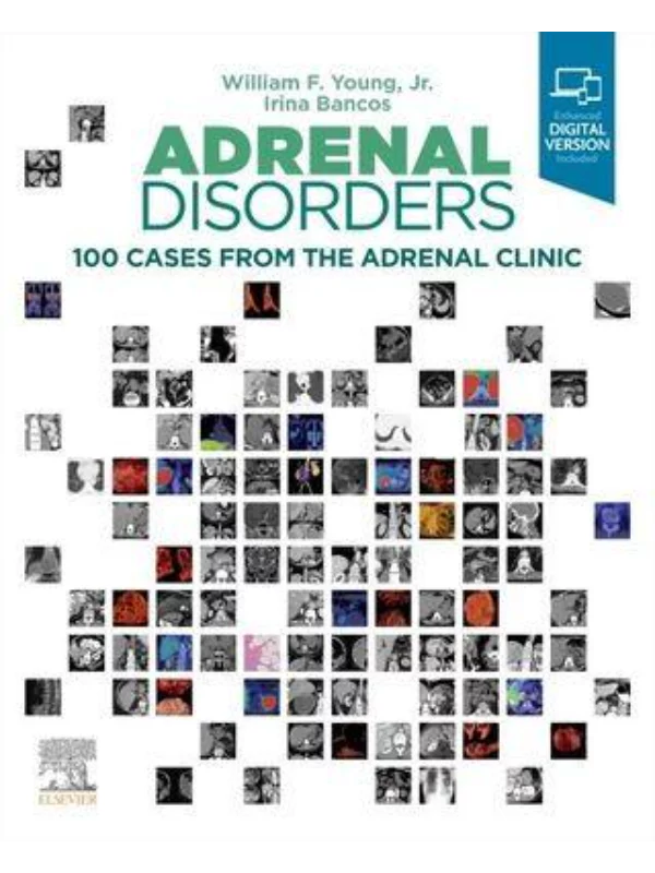 Adrenal Disorders100 Cases from the Adrenal Clinic - Image 1
