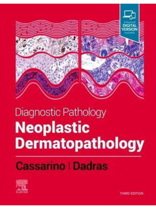 Diagnostic Pathology: Neoplastic Dermatopathology, 3rd Edition 1