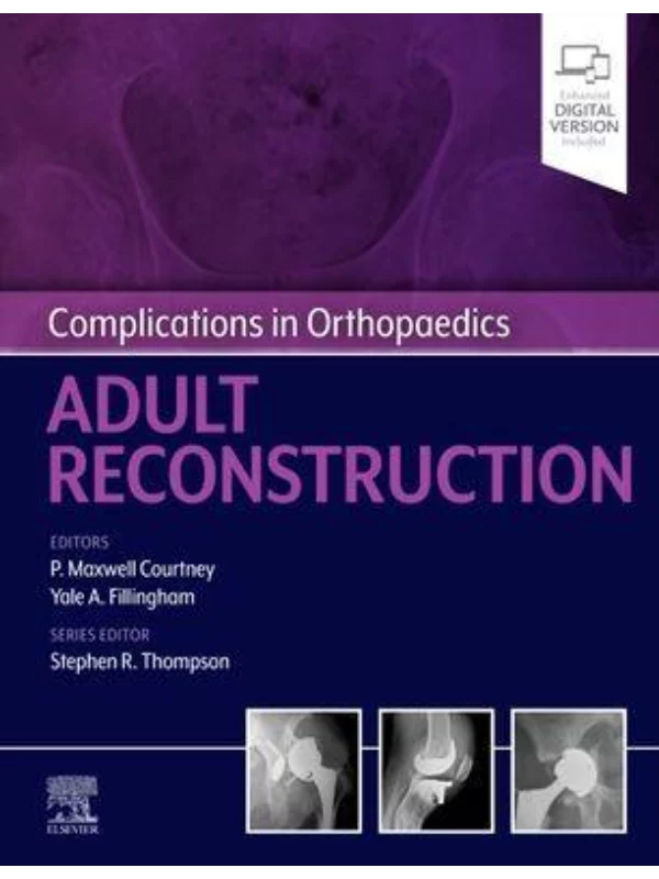 Complications in Orthopaedics: Adult Reconstruction - Image 1