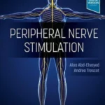 Peripheral Nerve Stimulation A Comprehensive Guide