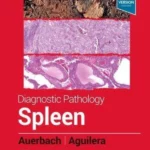 Diagnostic Pathology: Spleen, 2nd Edition