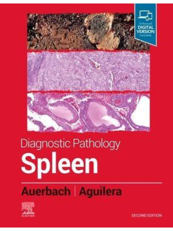 Diagnostic Pathology: Spleen, 2nd Edition 1