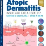 Atopic Dermatitis: Inside Out or Outside In
