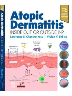 Atopic Dermatitis: Inside Out or Outside In 1