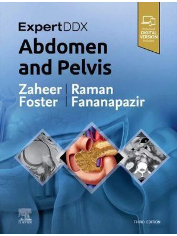 ExpertDDx: Abdomen and Pelvis, 3rd Edition - Image 1