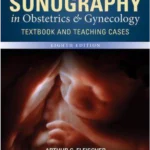 SONOGRAPHY IN OB GYN