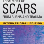 IE Treatment of Scars from Burns and Trauma