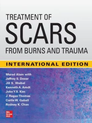 IE Treatment of Scars from Burns and Trauma 1