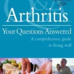 Arthritis Your Questions Answered