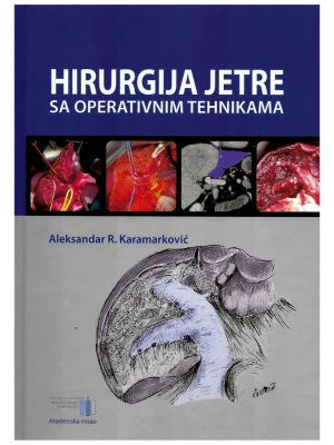 Hirurgija jetre sa operativnim tehnikama