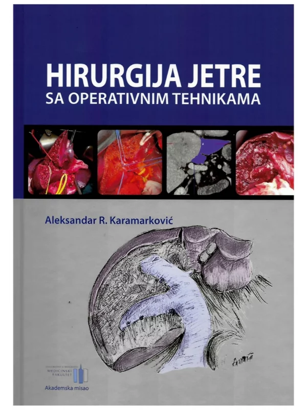 Hirurgija jetre sa operativnim tehnikama - Image 1