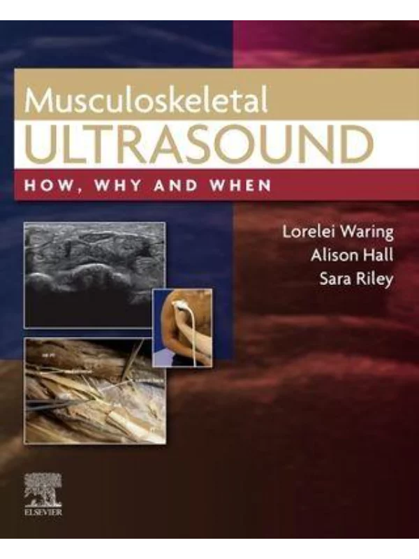Musculoskeletal UltrasoundHow, Why and When - Image 1