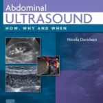 Abdominal Ultrasound, How, Why and When, 4th Edition