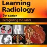 Learning Radiology, 5th Edition Recognizing the Basics