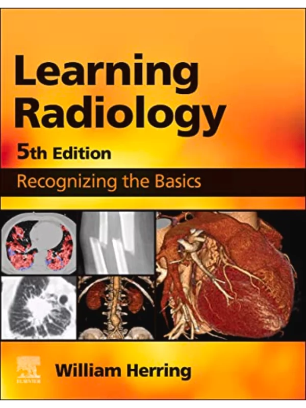 Learning Radiology, 5th Edition Recognizing the Basics 1
