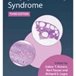 Polycystic Ovary Syndrome