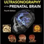 Timor's Ultrasonography of the Prenatal Brain, Fourth Edition 4th Edition