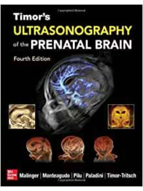 Timor's Ultrasonography of the Prenatal Brain, Fourth Edition 4th Edition 1
