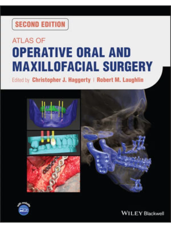 Atlas of Operative Oral and Maxillofacial Surgery, 2nd Edition - Image 1