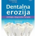Dentalna erozija