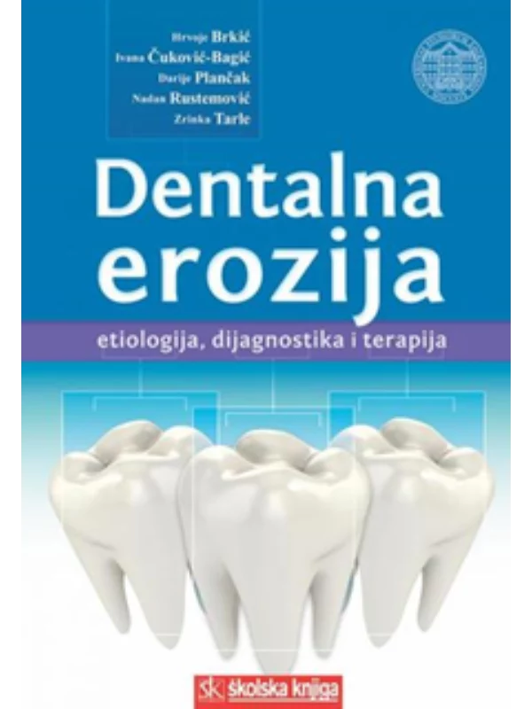Dentalna erozija - Image 1