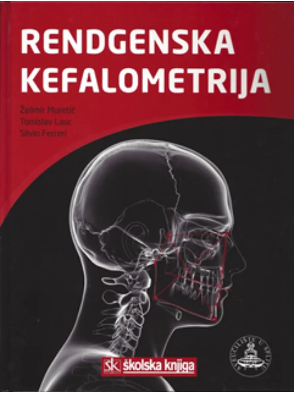 Rendgenska kefalometrija - Image 1