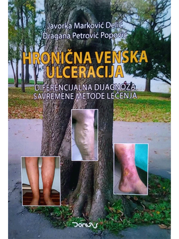 Hronična venska ulceracija-diferencijalna dijagnoza - Image 1