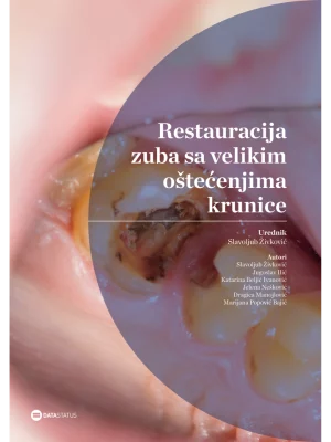 Restauracija zuba sa velikim oštećenjima krunice