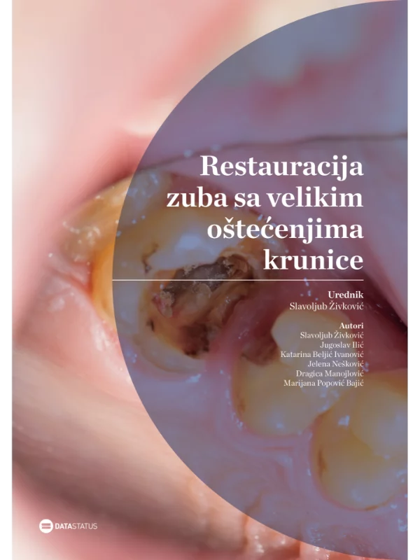 Restauracija zuba sa velikim oštećenjima krunice 1
