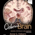 Osborn's Brain , 3rd Edition