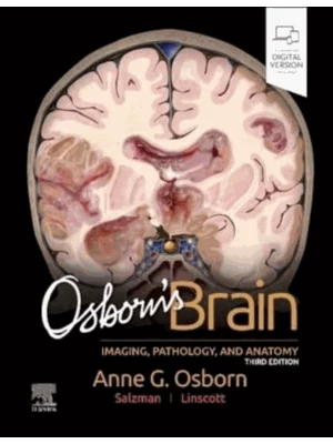 Osborn's Brain , 3rd Edition