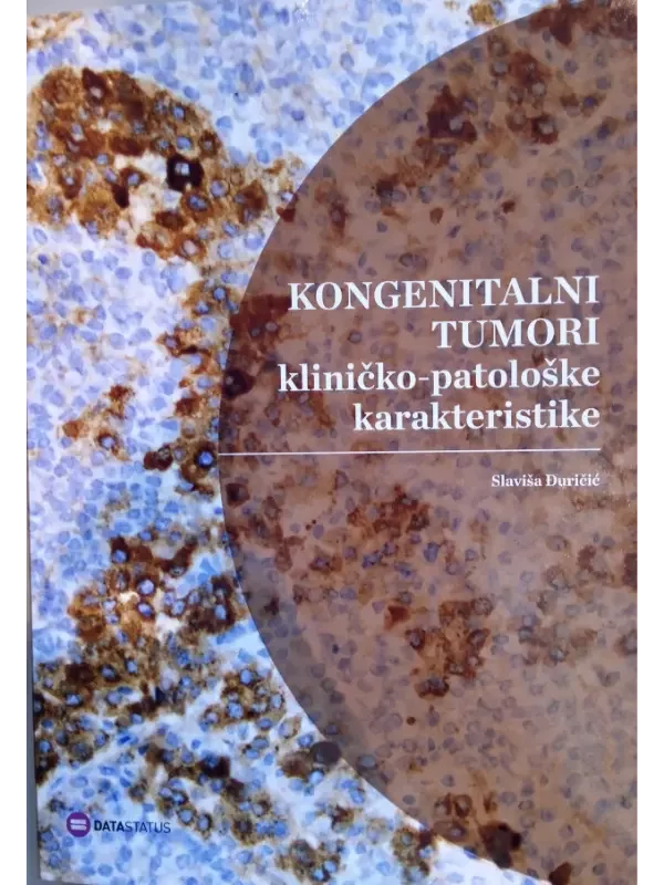 Kongenitalni tumori : kliničko-patološke karakteristike - Image 1