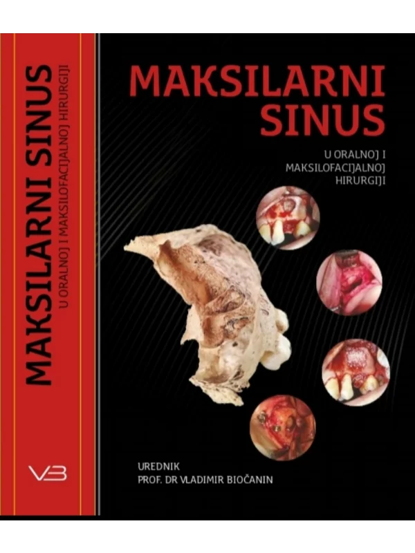 Maksilarni sinus u oralnoj i maksilofacijalnoj hirurgiji 1