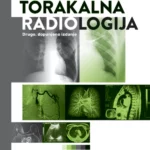 Torakalna Radiologija