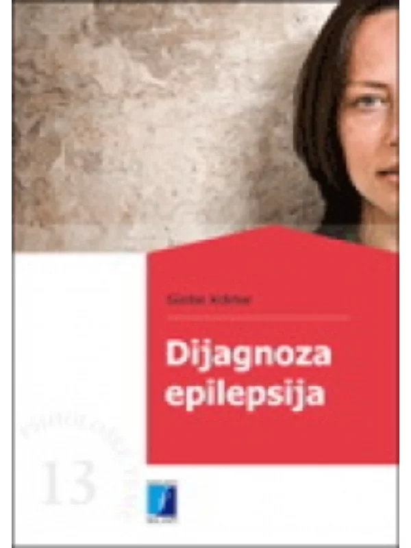 Dijagnoza epilepsija - Image 1