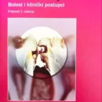 Zubni karijes-bolest i klinički postupci