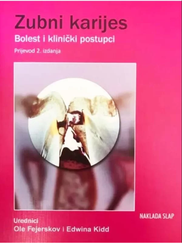 Zubni karijes-bolest i klinički postupci 1