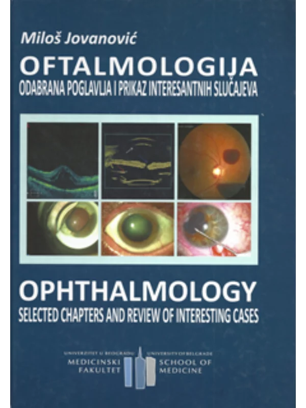 Oftalmologija : odabrana poglavlja i prikaz interesantnih slucajeva = Ophthalmology : selected chapters and review of interesting cases - Image 1