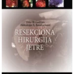 Z36146 Resekciona hirurgija jetre