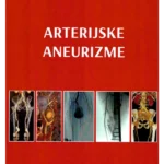 Arterijske aneurizme