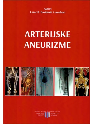 Arterijske aneurizme