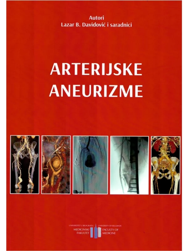 Arterijske aneurizme - Image 1