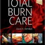Total Burn Care