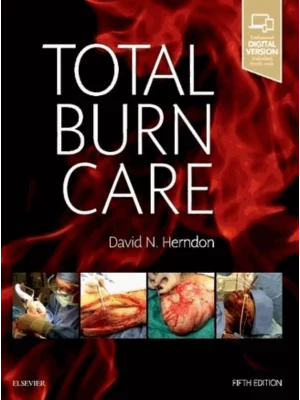 Total Burn Care