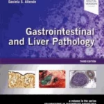 Gastrointestinal and Liver Pathology, A Volume in the Series: Foundations in Diagnostic Pathology, 3rd Edition