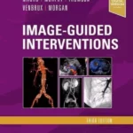 Image-Guided Interventions